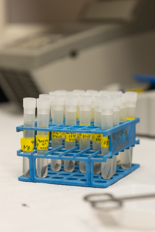 DNA Extraction for Striped Bass Fin Clipping Photo 3 DNA Extraction for Striped Bass Fin Clipping Photo 3